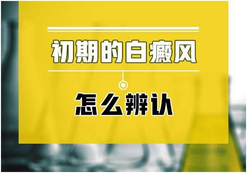 白癜風(fēng)初期是什么樣的